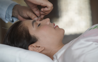 acupuncture face treatment